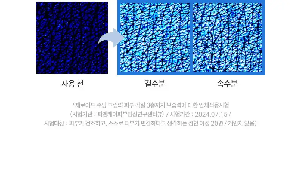 [대용량] 제로이드 수딩 크림 80ml 기획 (+50ml) 상세페이지 26
